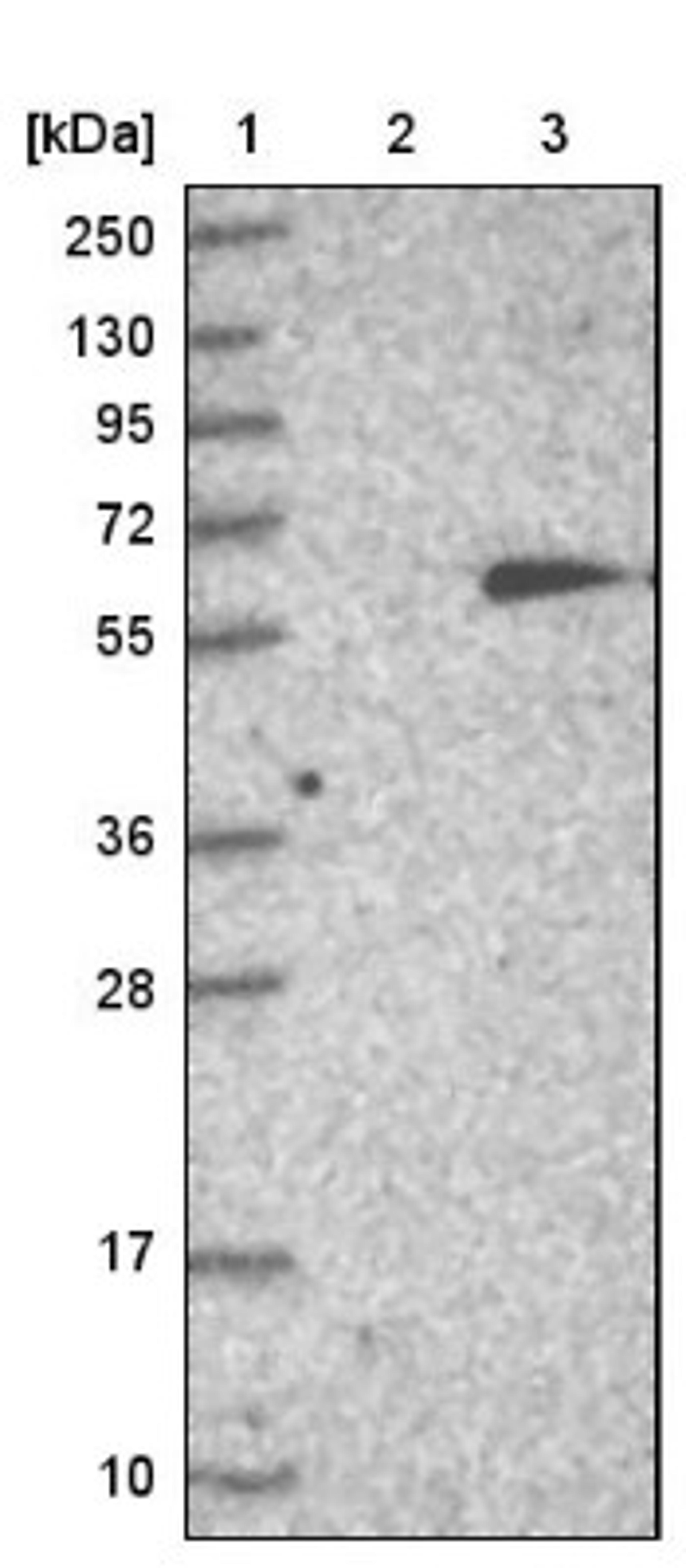 Western Blot: MTAC2D1 Antibody [NBP1-89900] - Lane 1: Marker [kDa] 250, 130, 95, 72, 55, 36, 28, 17, 10<br/>Lane 2: Negative control (vector only transfected HEK293T lysate)<br/>Lane 3: Over-expression lysate (Co-expressed with a C-terminal myc-DDK tag (~3.1 kDa) in mammalian HEK293T cells, LY403463)