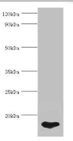 Western blot. All lanes: FABP5 antibody at 5ug/ml + HepG2 whole cell lysate. Secondary. Goat polyclonal to rabbit IgG at 1/10000 dilution. Predicted band size: 15 kDa. Observed band size: 15 kDa. 