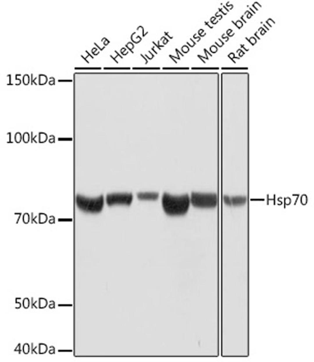 Western blot - Hsp70 Rabbit mAb (A4777)