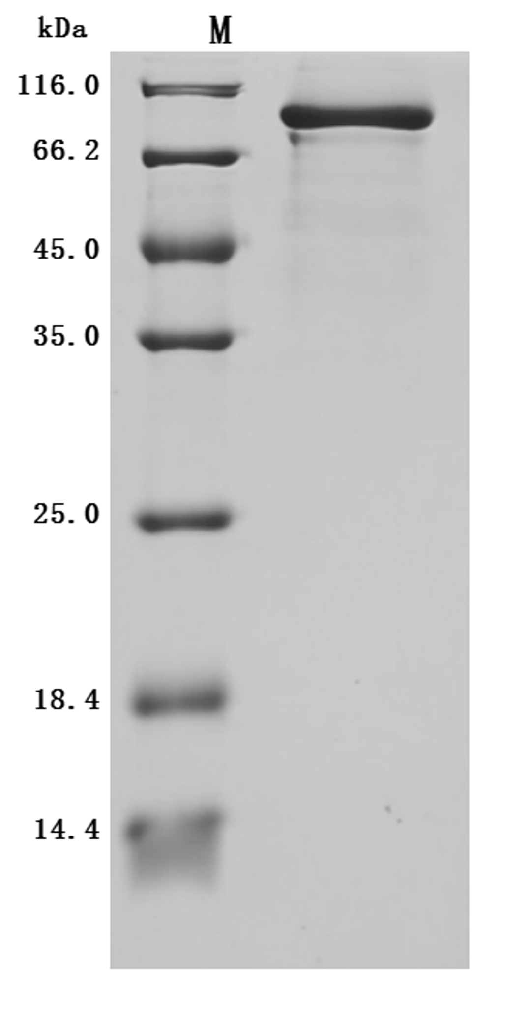 (Tris-Glycine gel) Discontinuous SDS-PAGE (reduced) with 5% enrichment gel and 15% separation gel.