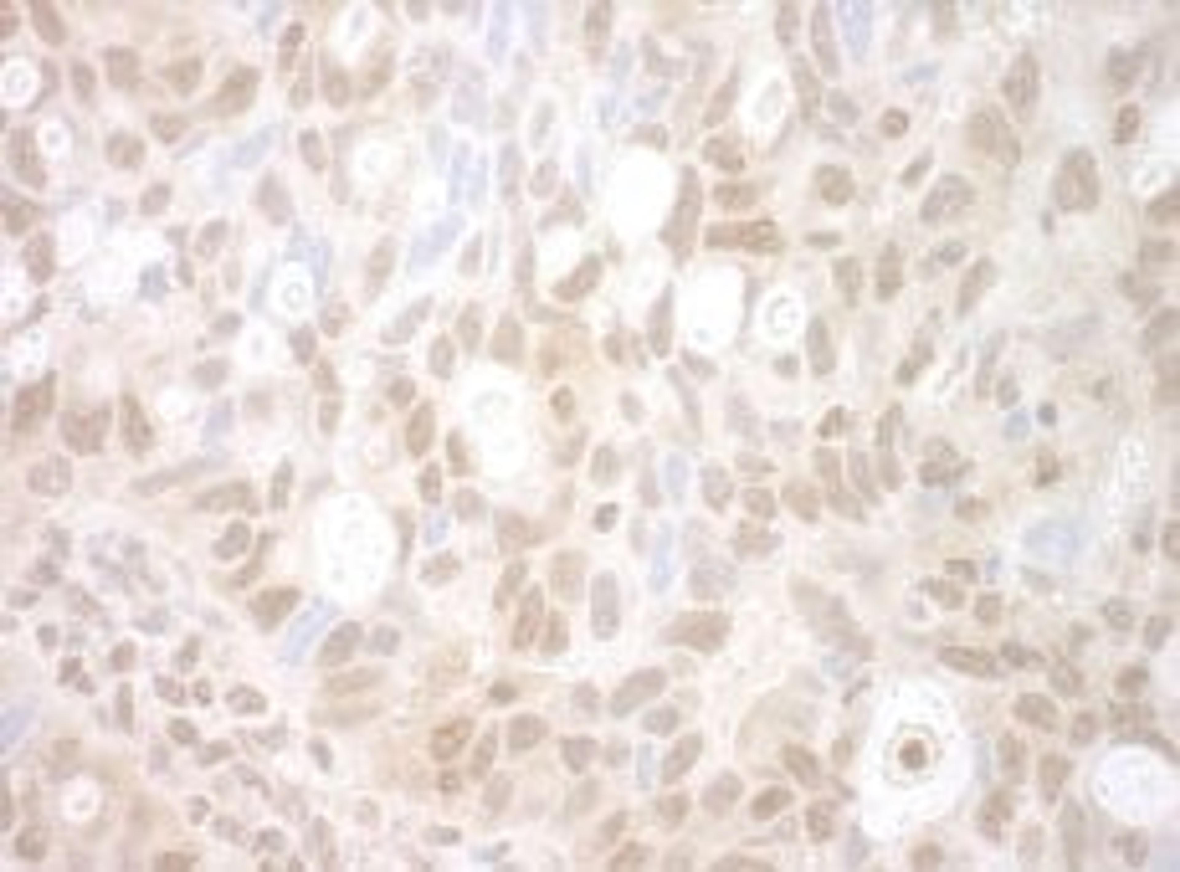 Detection of human PHF20 by immunohistochemistry.