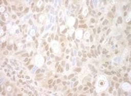 Detection of human PHF20 by immunohistochemistry.