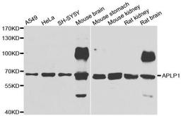 Western blot analysis of extracts of various cell lines using APLP1 antibody