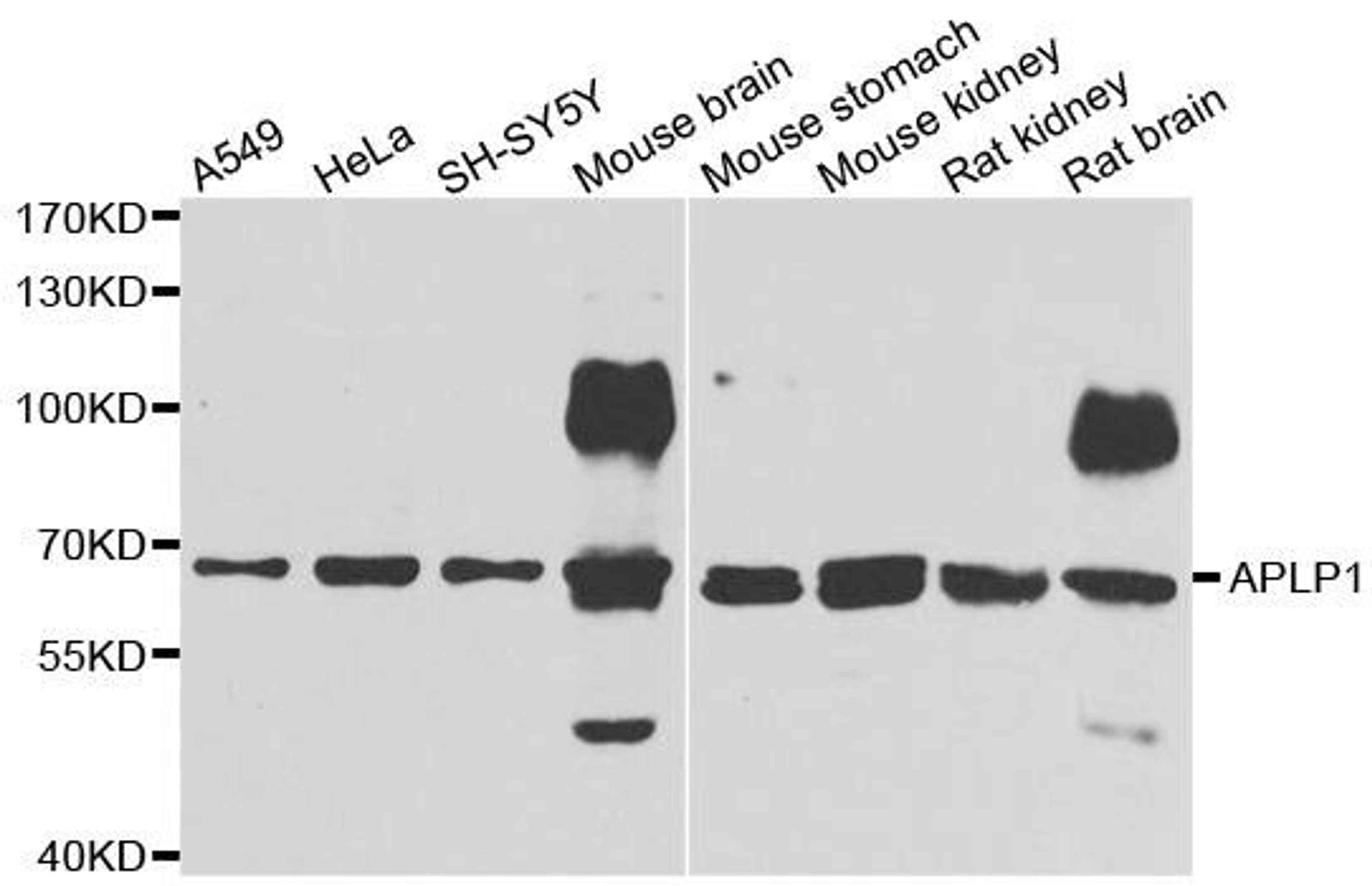 Western blot analysis of extracts of various cell lines using APLP1 antibody