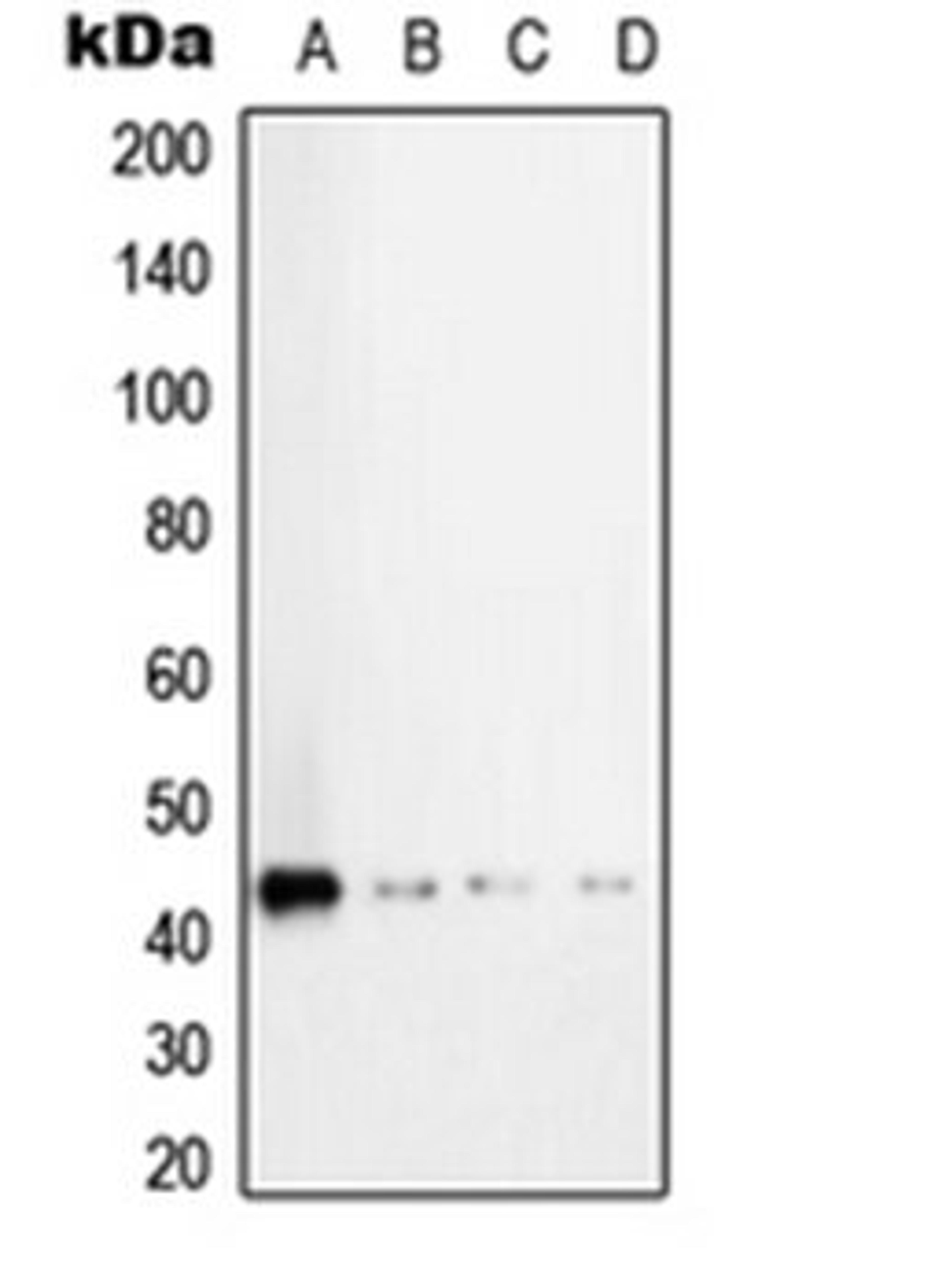 Western blot analysis of HeLa (Lane 1), MCF7 (Lane 2), SP2/0 (Lane 3), H9C2 (Lane 4) whole cell lysates using TGFB1 antibody