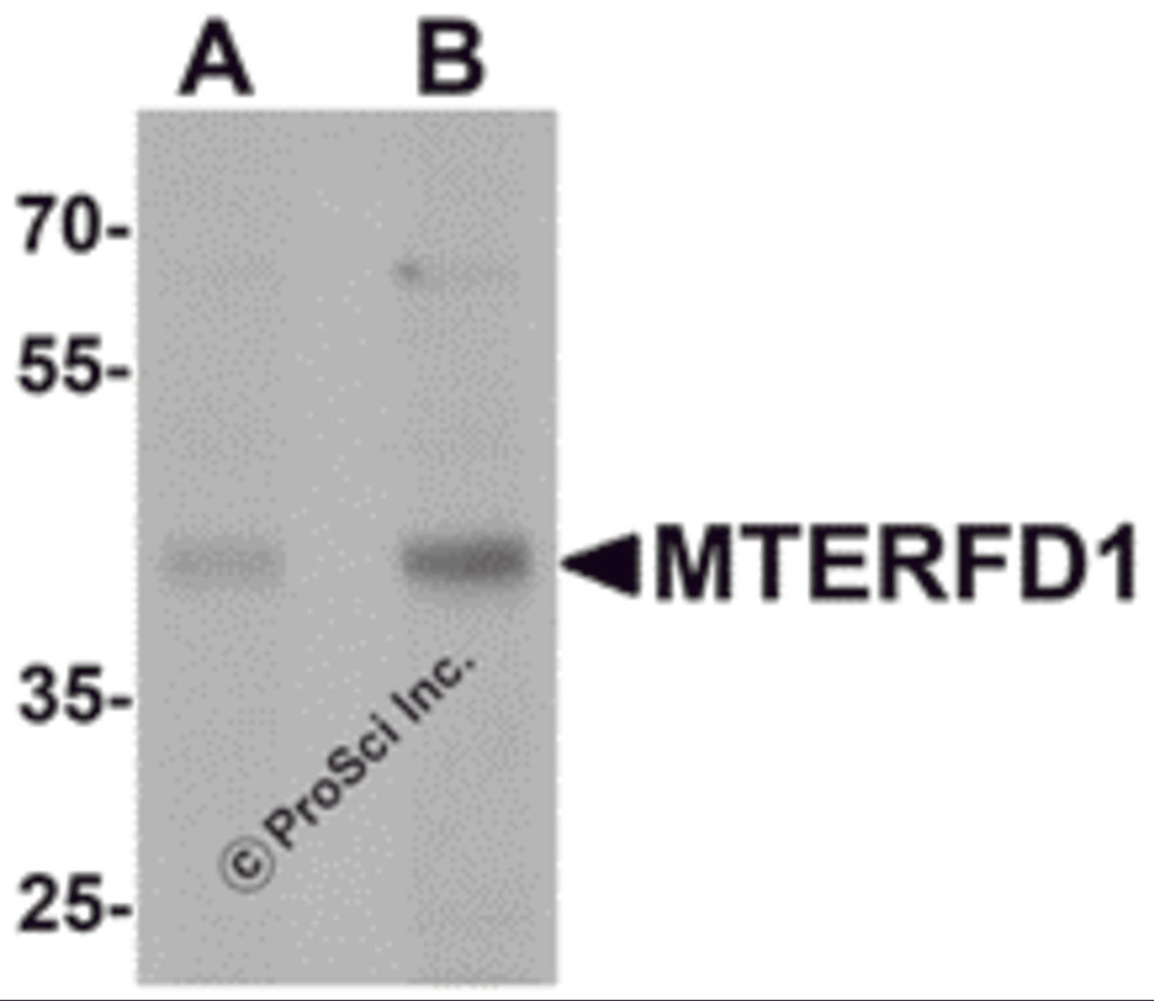 Western blot analysis of MTERFD1 in 3T3 cell lysate with MTERFD1 antibody at (A) 1 and (B) 2 μg/mL.