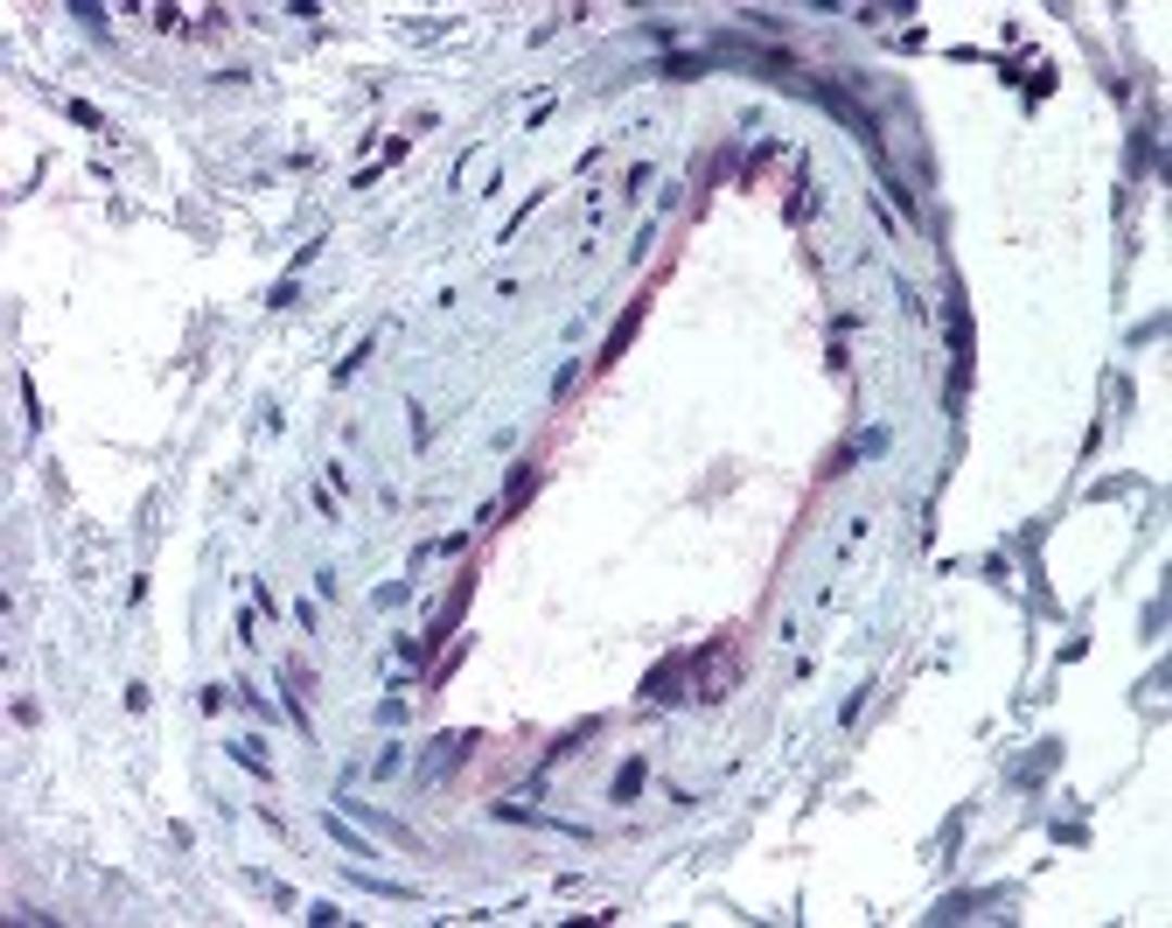 Immunohistochemistry staining of ACVR1 in skeletal muscle, vessel tissue using ACVR1 Antibody.