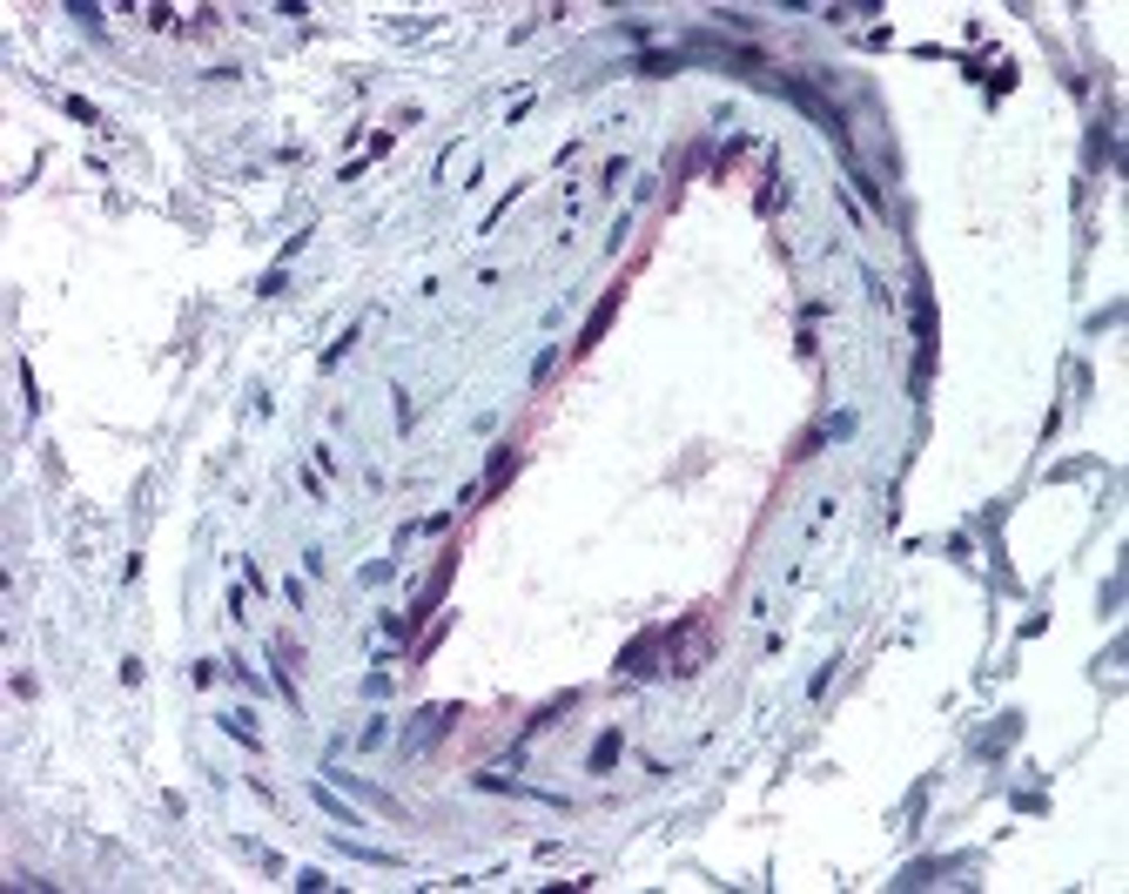 Immunohistochemistry staining of ACVR1 in skeletal muscle, vessel tissue using ACVR1 Antibody.