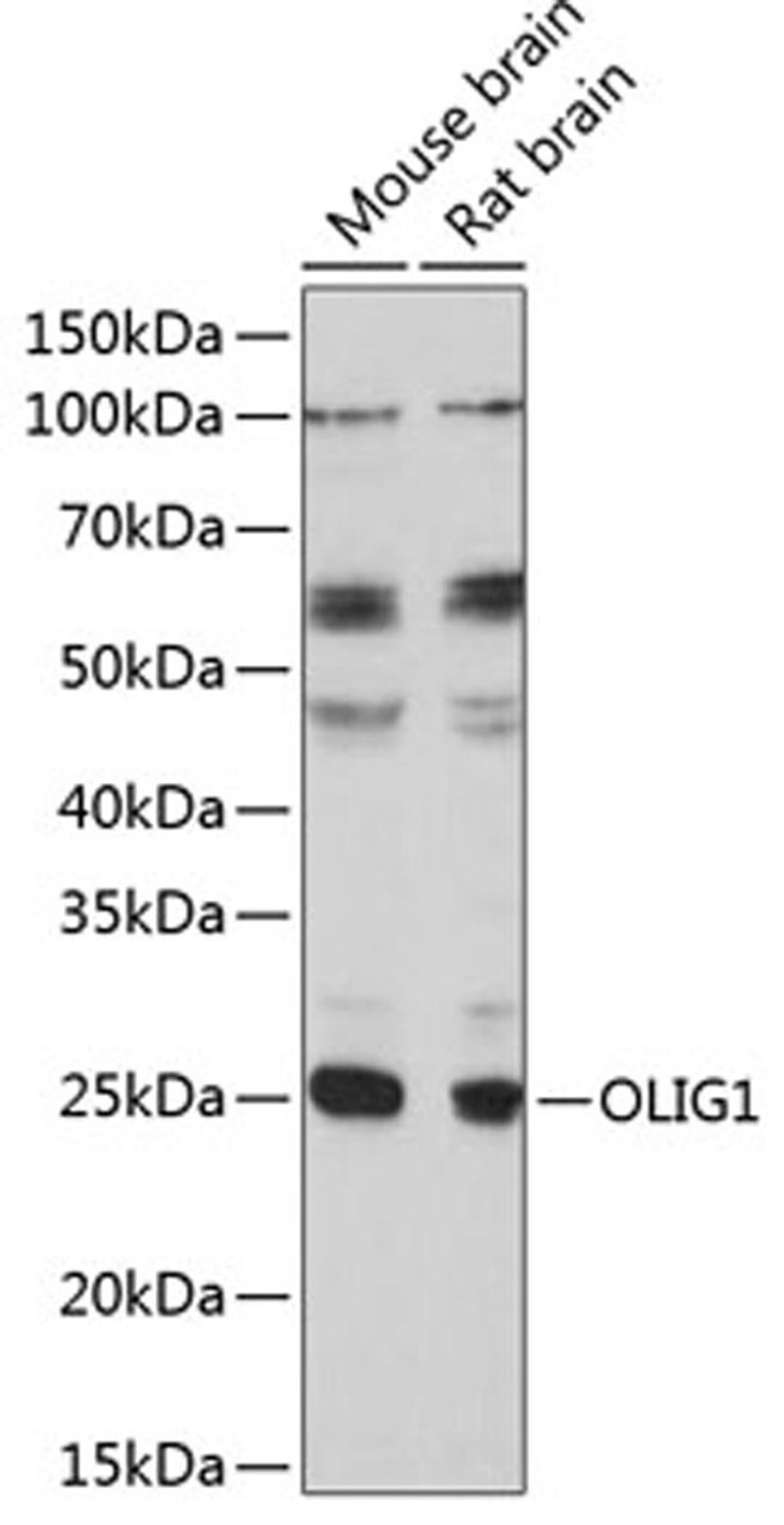 Western blot - OLIG1 Polyclonal Antibody (A17251)