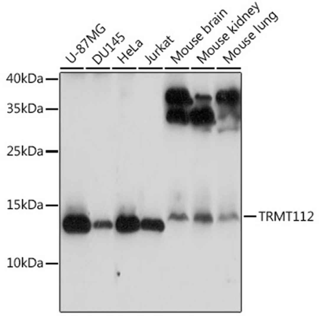 Western blot - TRMT112 antibody (A14310)