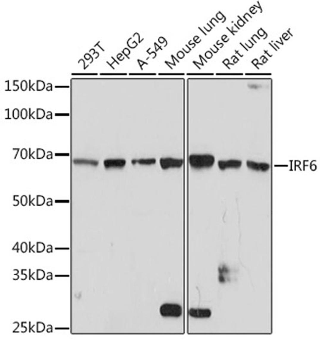Western blot - IRF6 Rabbit mAb (A3209)
