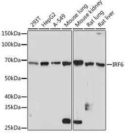 Western blot - IRF6 Rabbit mAb (A3209)