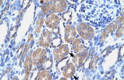 Antibody used in IHC on Human kidney.