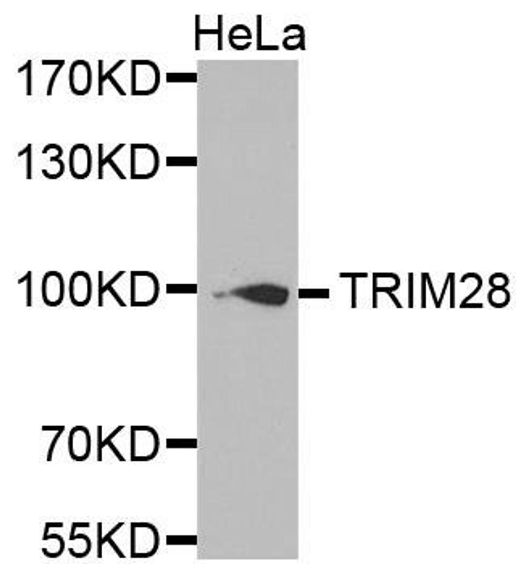 Western blot analysis of extracts of HeLa cell line using TIF1Beta antibody