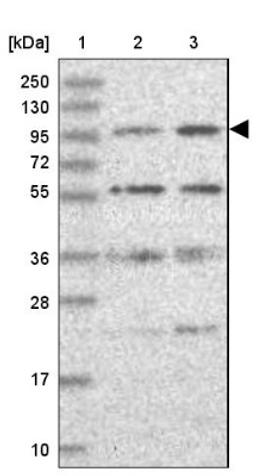 Western Blot: KIF18A Antibody [NBP1-85126] - Lane 1: Marker [kDa] 250, 130, 95, 72, 55, 36, 28, 17, 10<br/>Lane 2: Human cell line RT-4<br/>Lane 3: Human cell line U-251MG sp