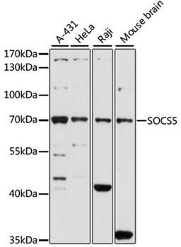 Western blot - SOCS5 antibody (A7952)