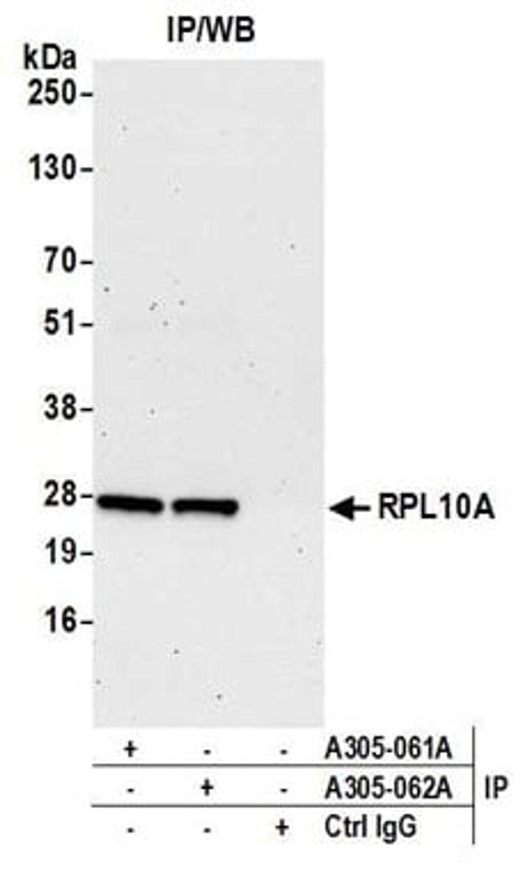 Detection of human RPL10A by western blot of immunoprecipitates.