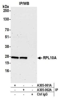 Detection of human RPL10A by western blot of immunoprecipitates.