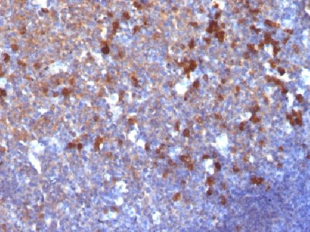 Immunohistochemical staining of human Tonsil tissue using IGHG antibody