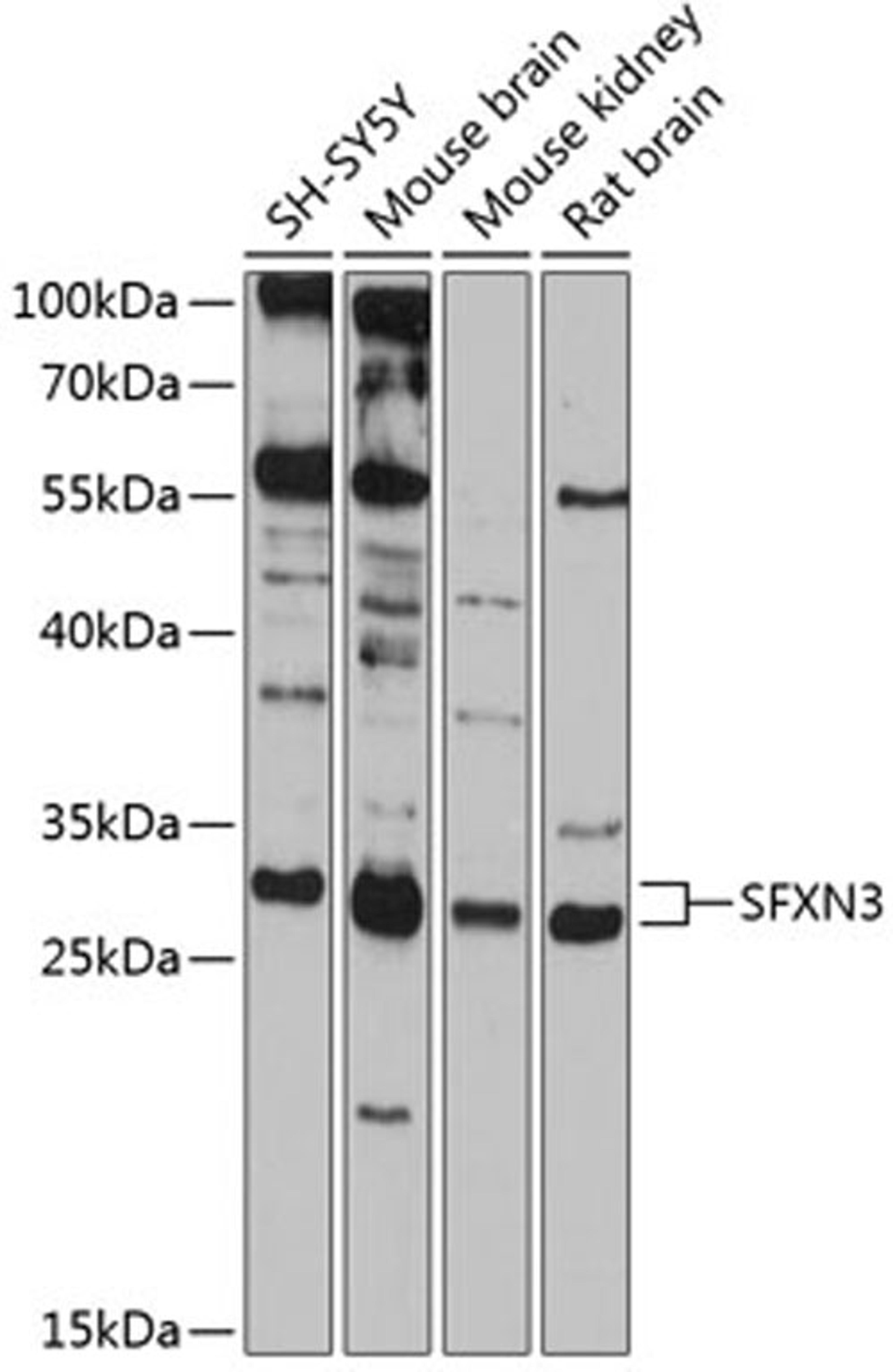 Western blot - SFXN3 antibody (A12298)