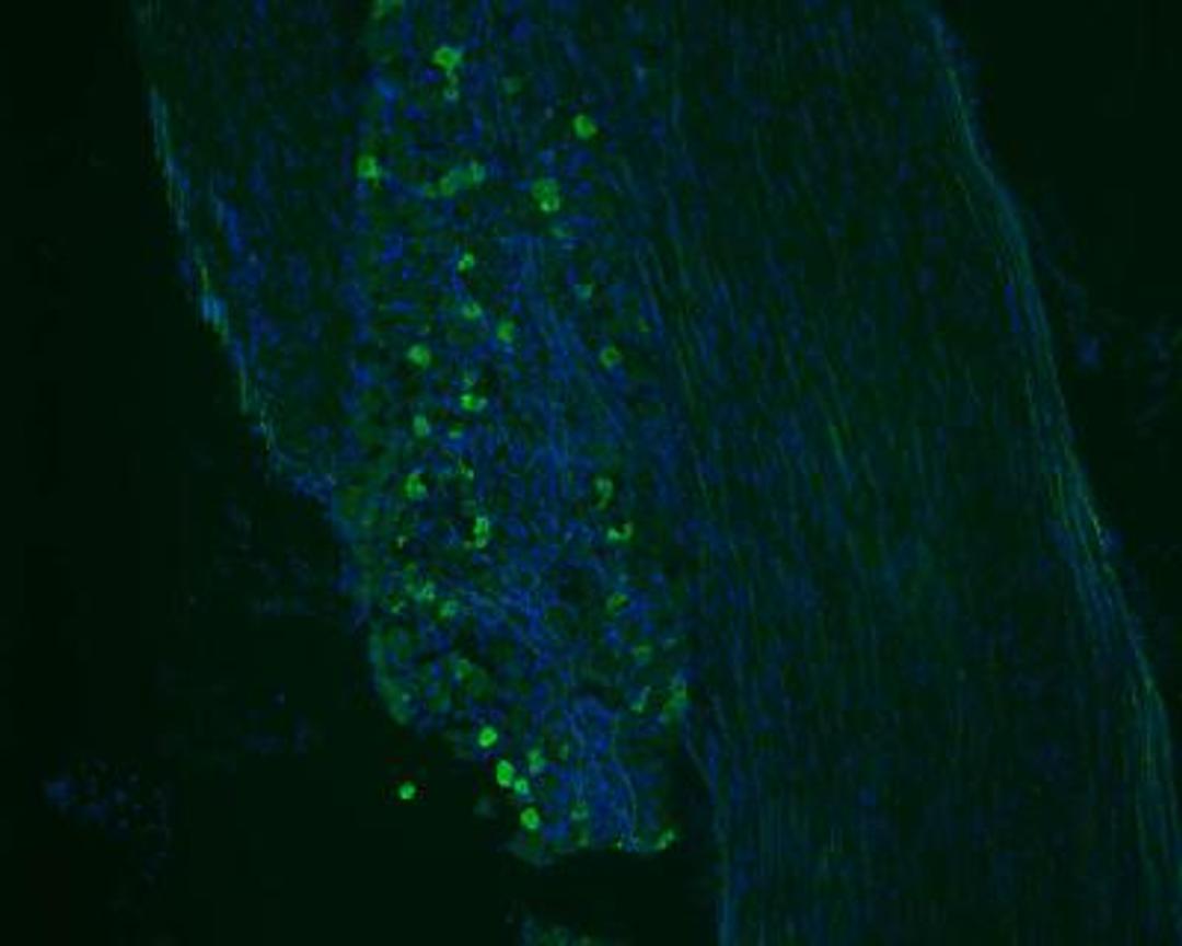 Immunocytochemistry/Immunofluorescence: GFP Antibody [NB100-1614] - IF analysis of GFP in mouse trigeminal ganglia, cornea. Image courtesy of product review by Jessica Newsom.