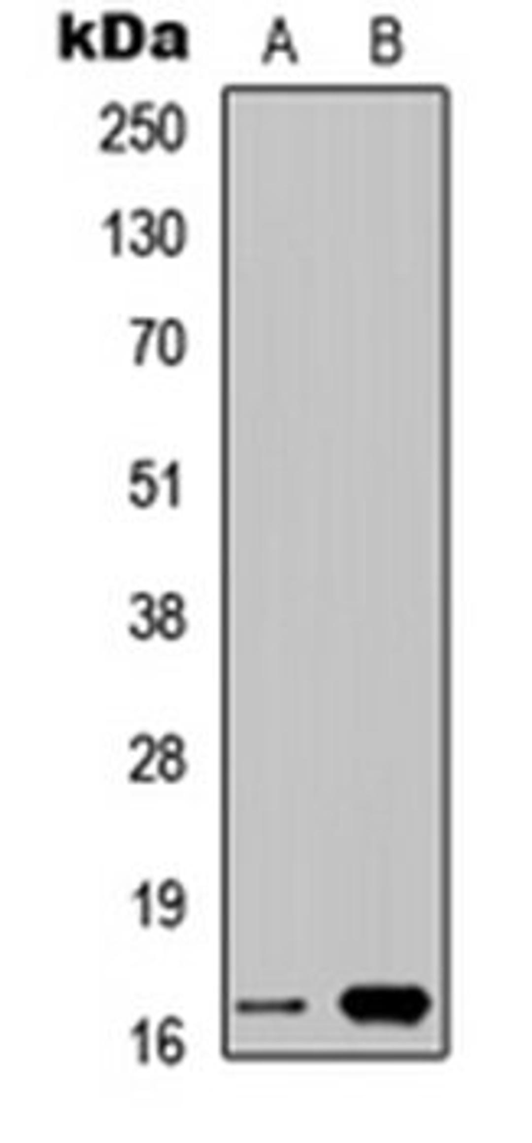 Western blot analysis of HEK293T (Lane 1), PC12 (Lane 2) whole cell lysates using Cystatin 9L1 antibody