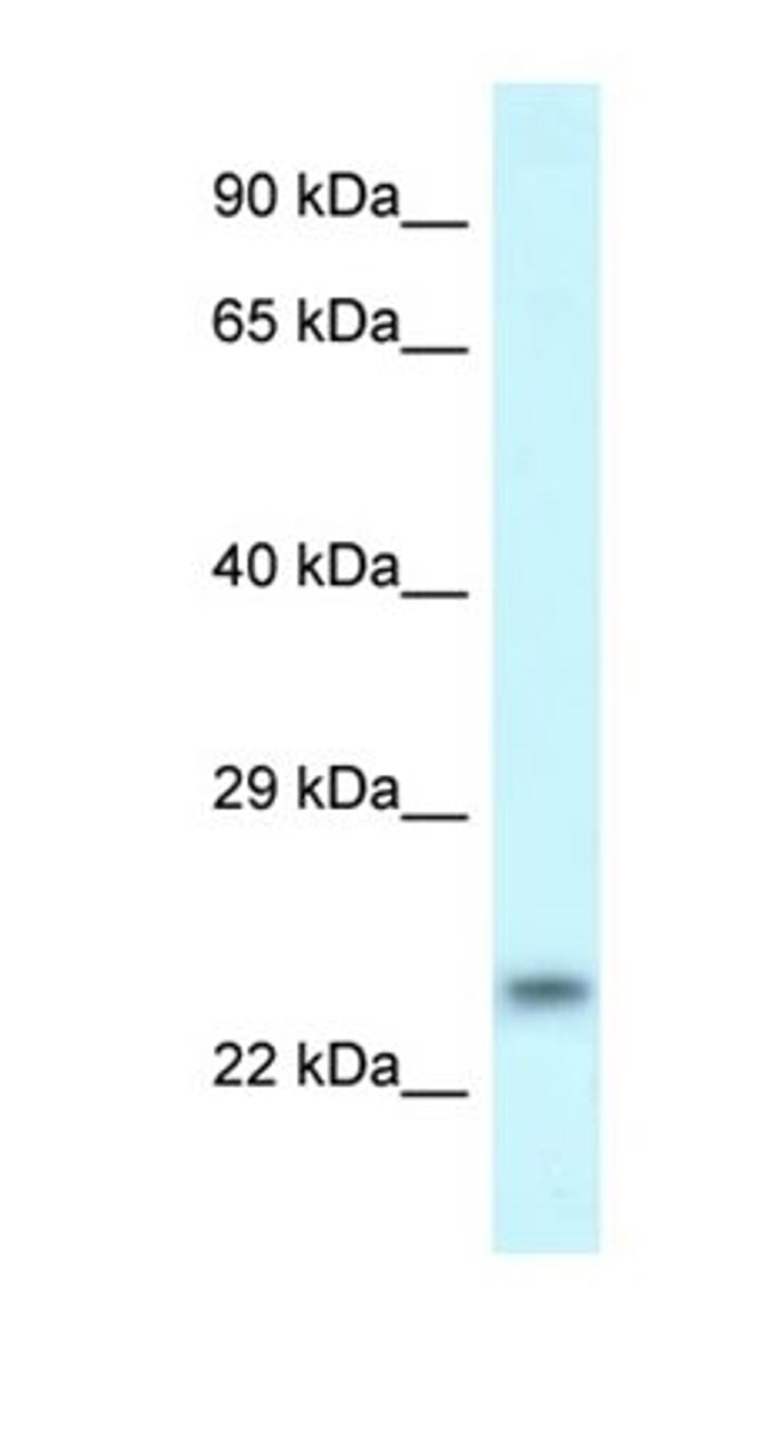 Western blot analysis of THP-1 Whole Cell tissue using RND1 antibody