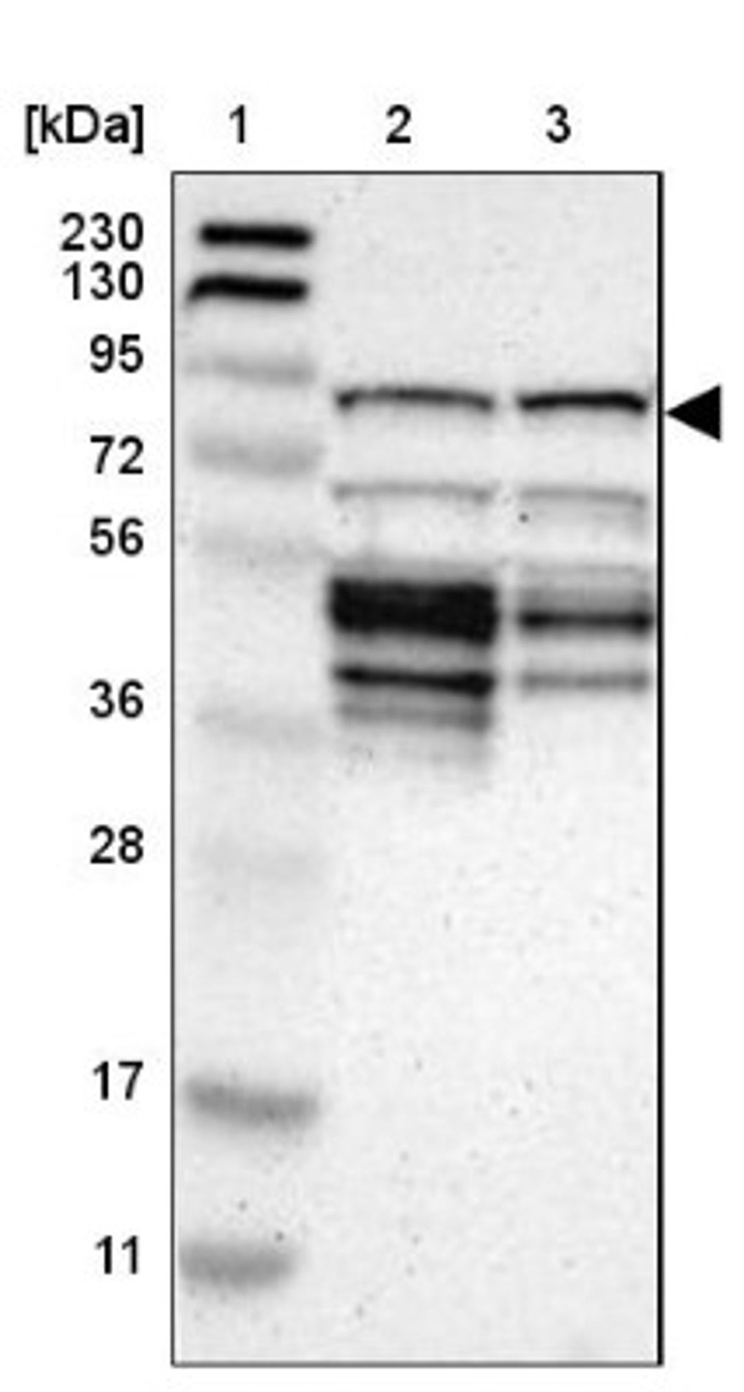 Western Blot: CKAP2 Antibody [NBP1-84602] - Lane 1: Marker [kDa] 230, 130, 95, 72, 56, 36, 28, 17, 11<br/>Lane 2: Human cell line RT-4<br/>Lane 3: Human cell line U-251MG sp