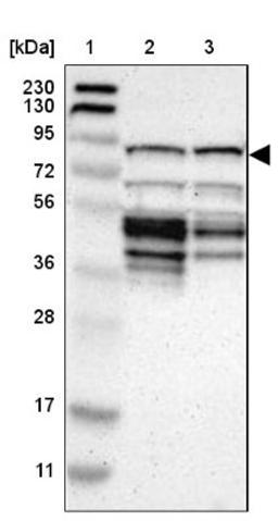 Western Blot: CKAP2 Antibody [NBP1-84602] - Lane 1: Marker [kDa] 230, 130, 95, 72, 56, 36, 28, 17, 11<br/>Lane 2: Human cell line RT-4<br/>Lane 3: Human cell line U-251MG sp