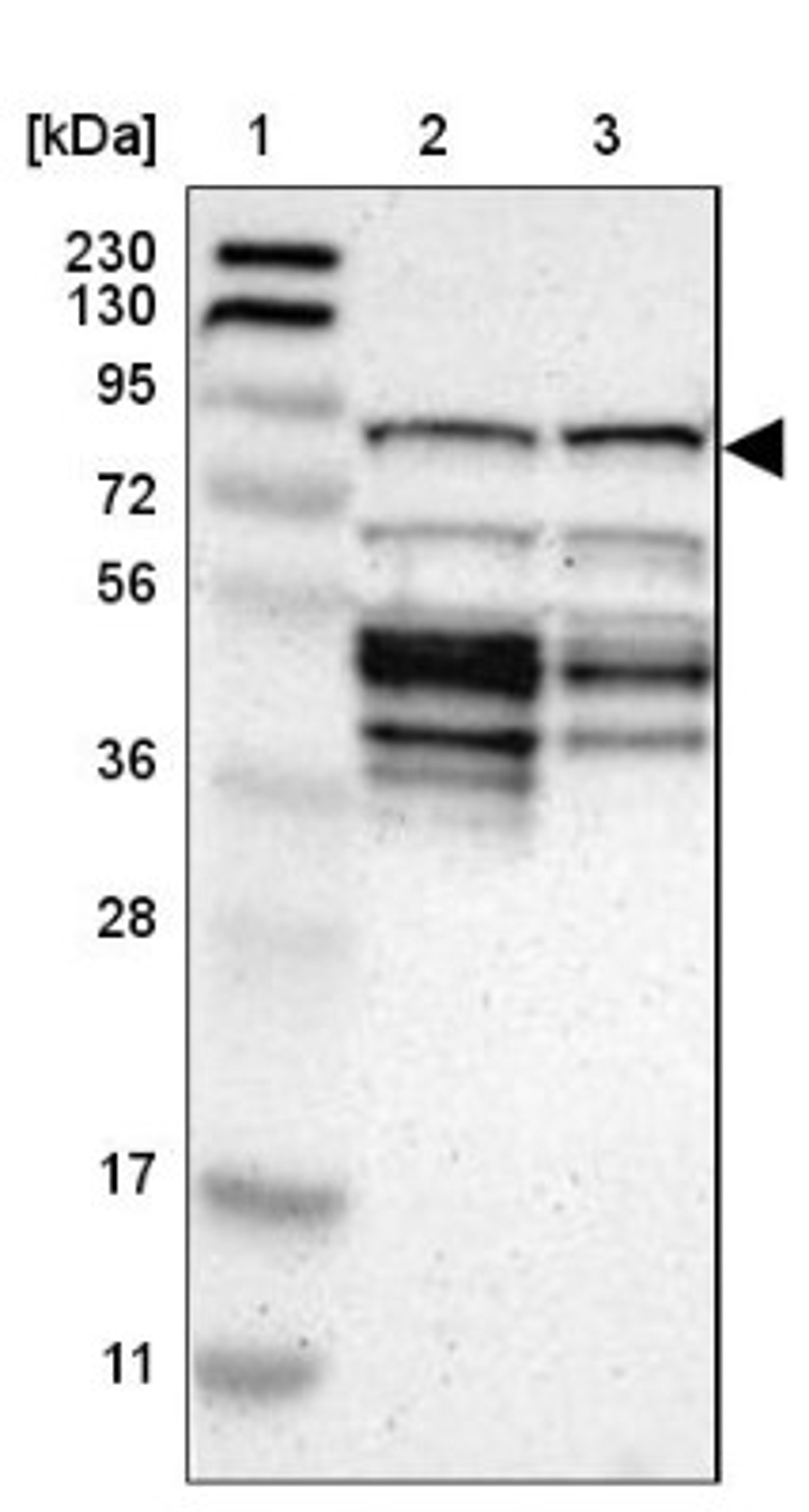 Western Blot: CKAP2 Antibody [NBP1-84602] - Lane 1: Marker [kDa] 230, 130, 95, 72, 56, 36, 28, 17, 11<br/>Lane 2: Human cell line RT-4<br/>Lane 3: Human cell line U-251MG sp