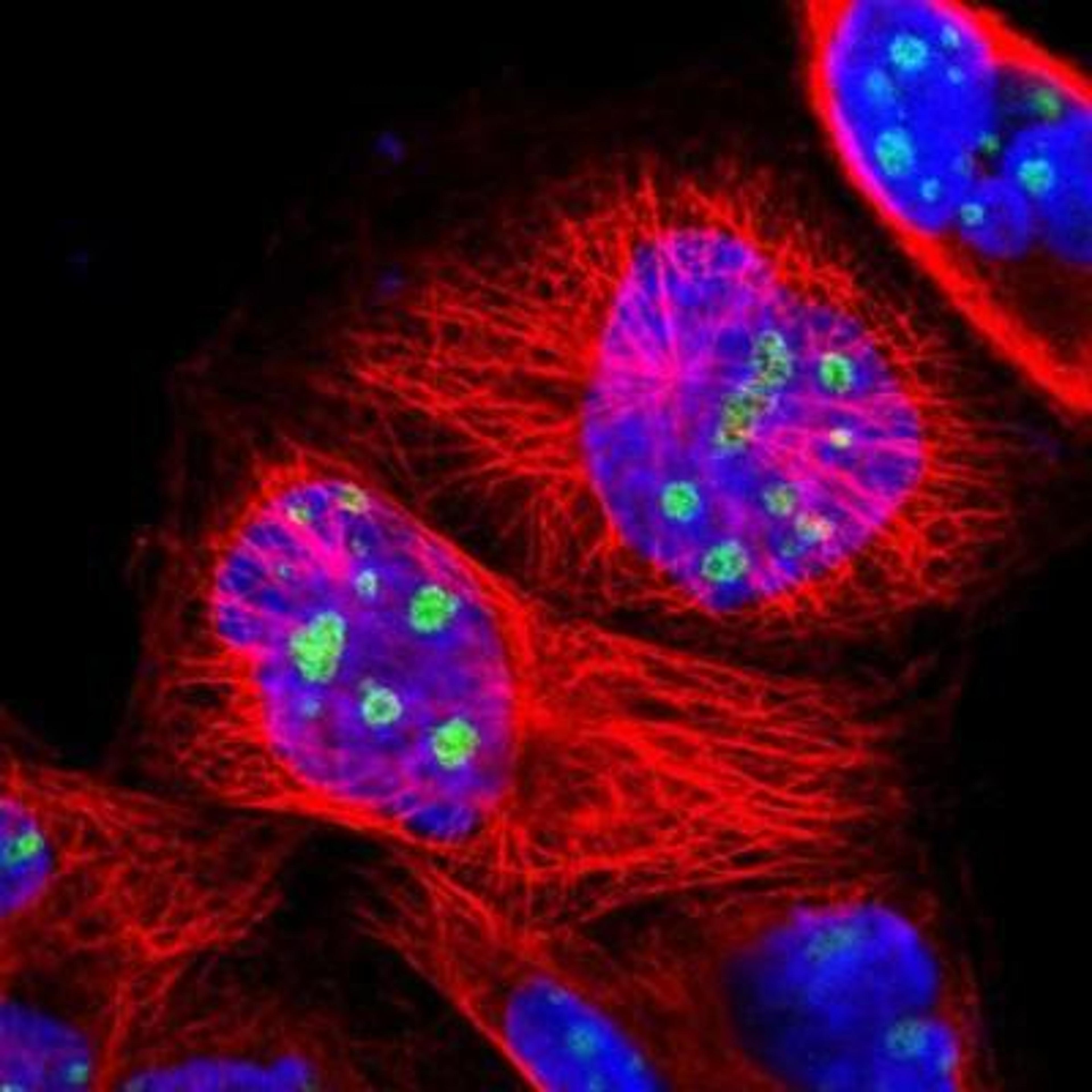 Immunocytochemistry/Immunofluorescence: CHX10 Antibody [NBP1-84476] - Staining of human cell line A-431 shows positivity in nucleoli.