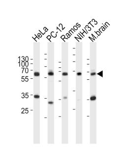 Western blot analysis of lysates from HeLa, rat PC-12, Ramos, mouse NIH/3T3 cell line, mouse brain tissue lysate(from left to right), using PKM2-N491 at 1:1000 at each lane.