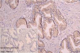 Immunohistochemistry of paraffin-embedded human heart tissue using CSB-PA896913ESR1HU at dilution of 1:100