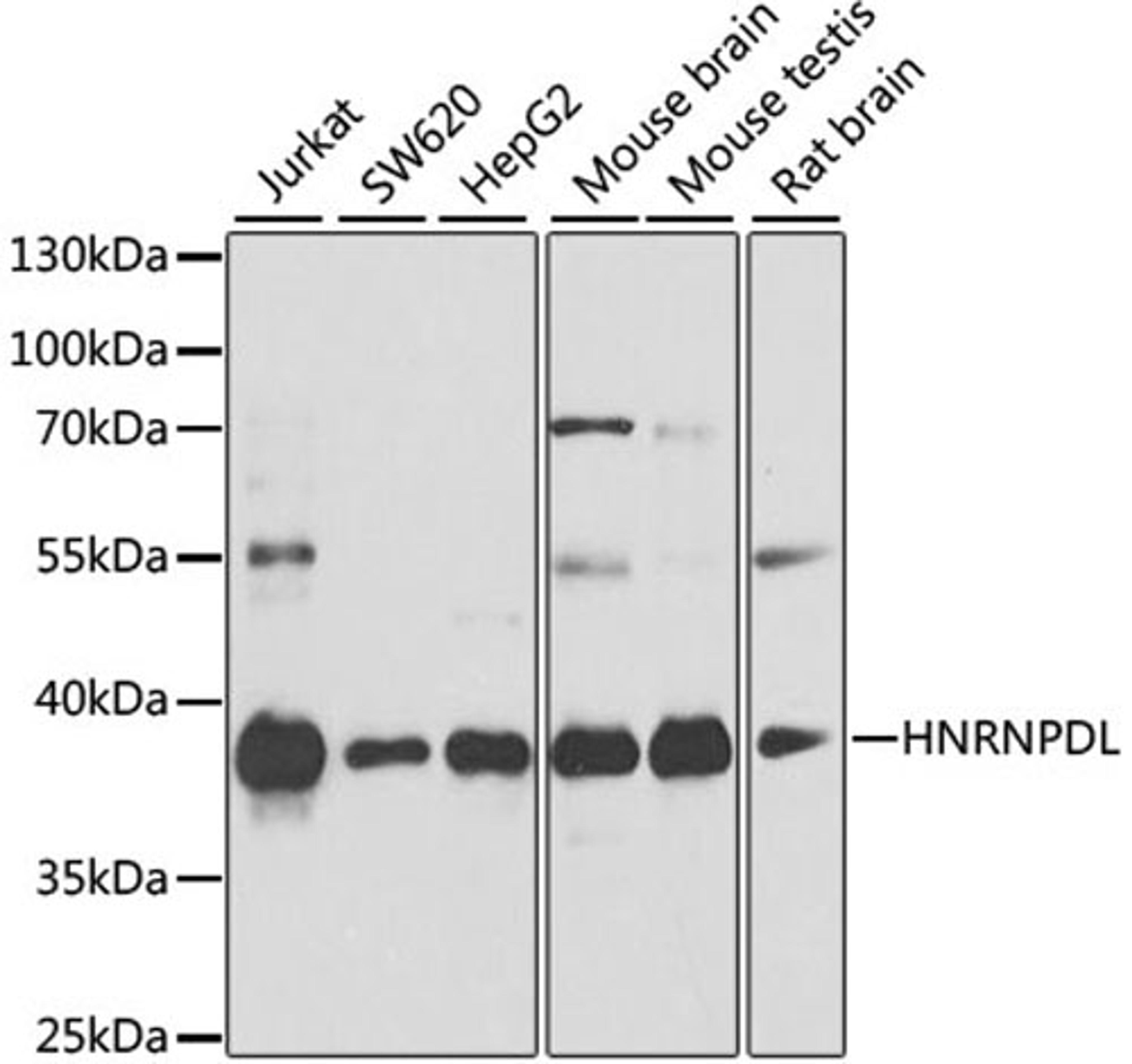 Western blot - HNRNPDL antibody (A10721)