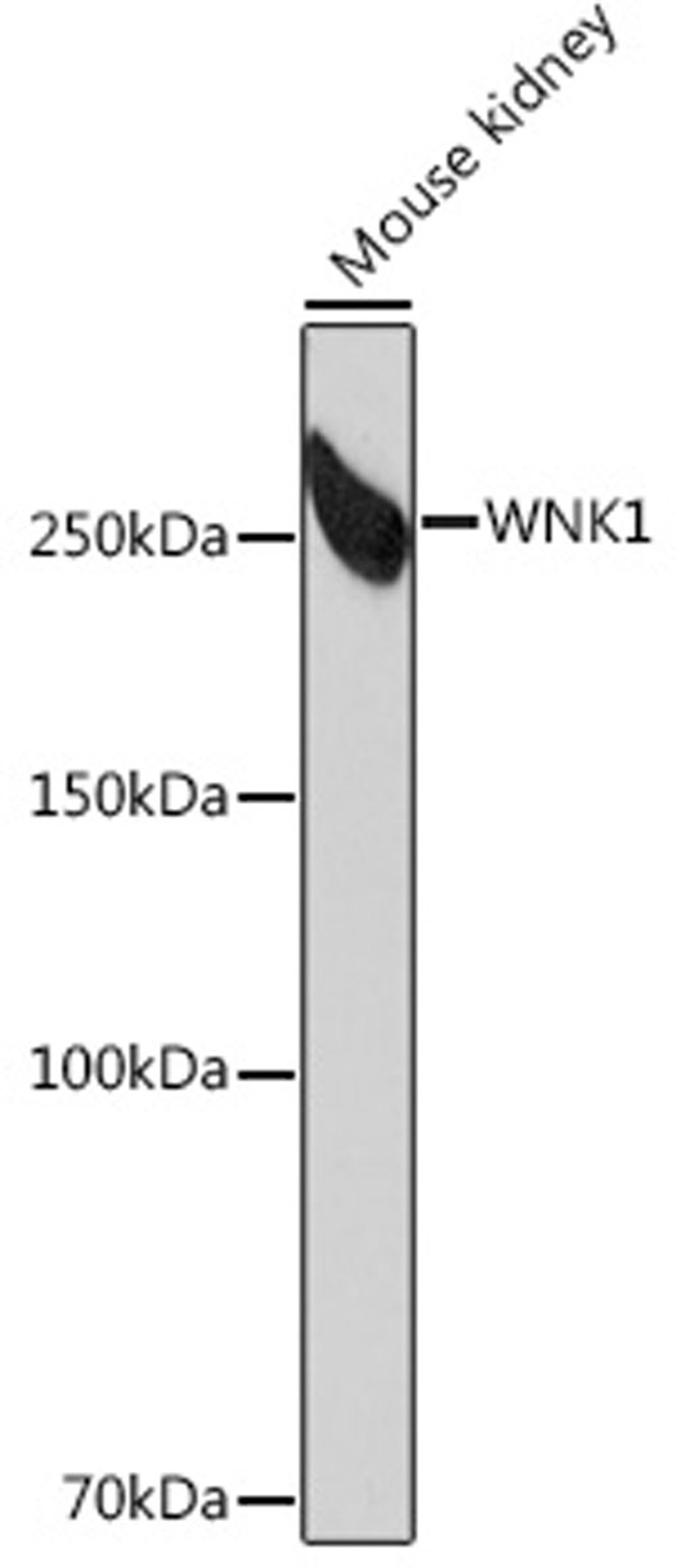 Western blot - WNK1 Rabbit mAb (A4223)