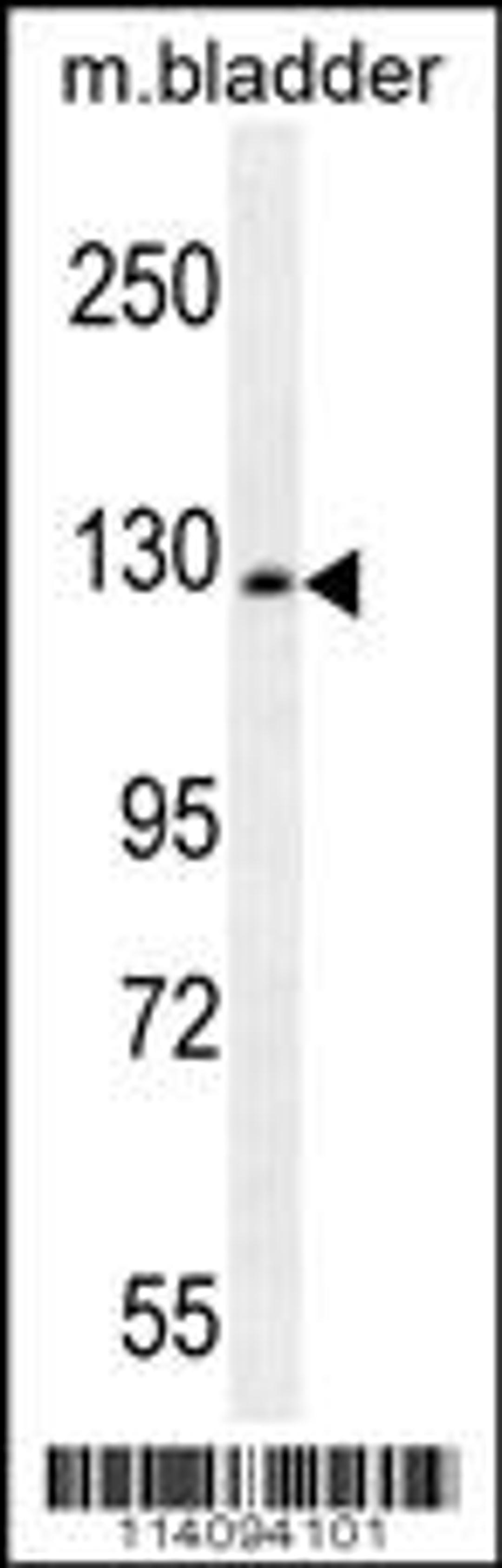 Western blot analysis in mouse bladder tissue lysates (35ug/lane).