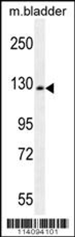 Western blot analysis in mouse bladder tissue lysates (35ug/lane).