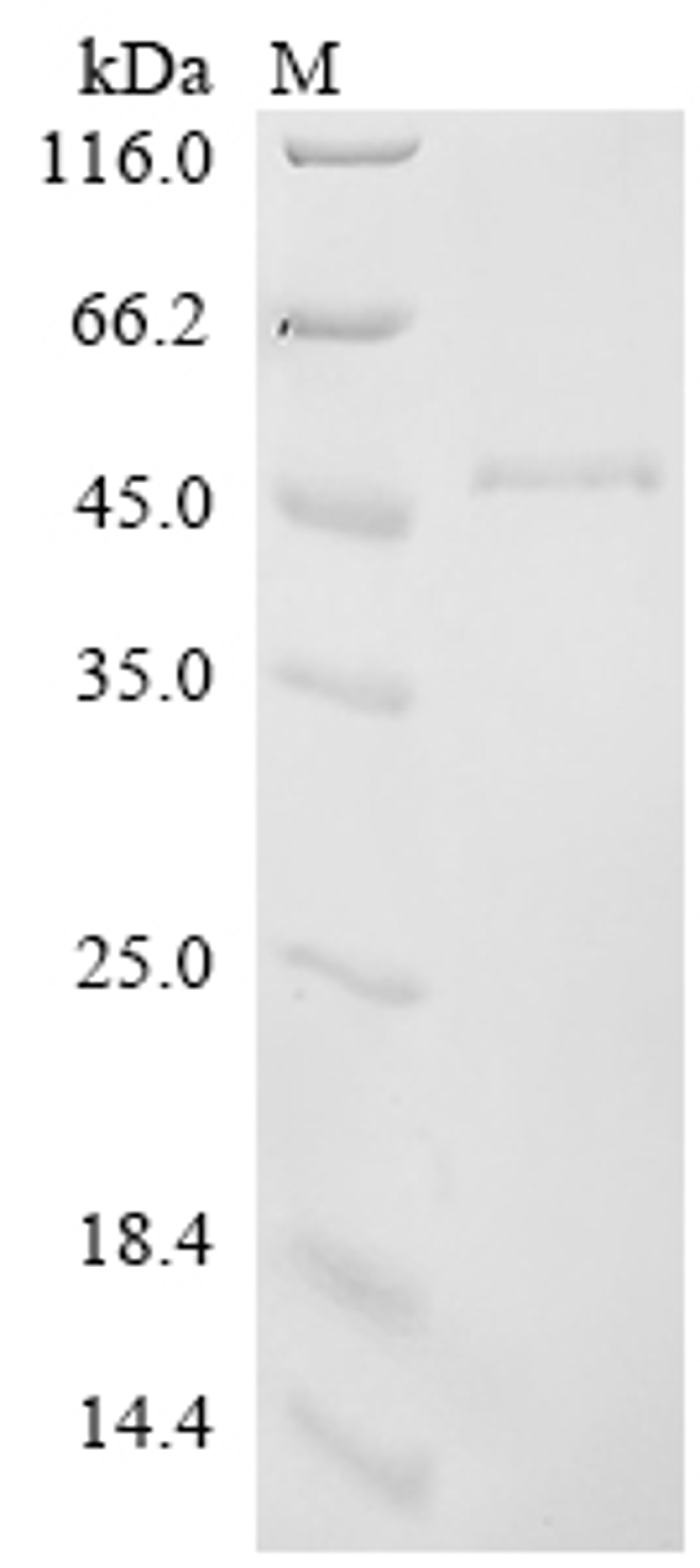 (Tris-Glycine gel) Discontinuous SDS-PAGE (reduced) with 5% enrichment gel and 15% separation gel.