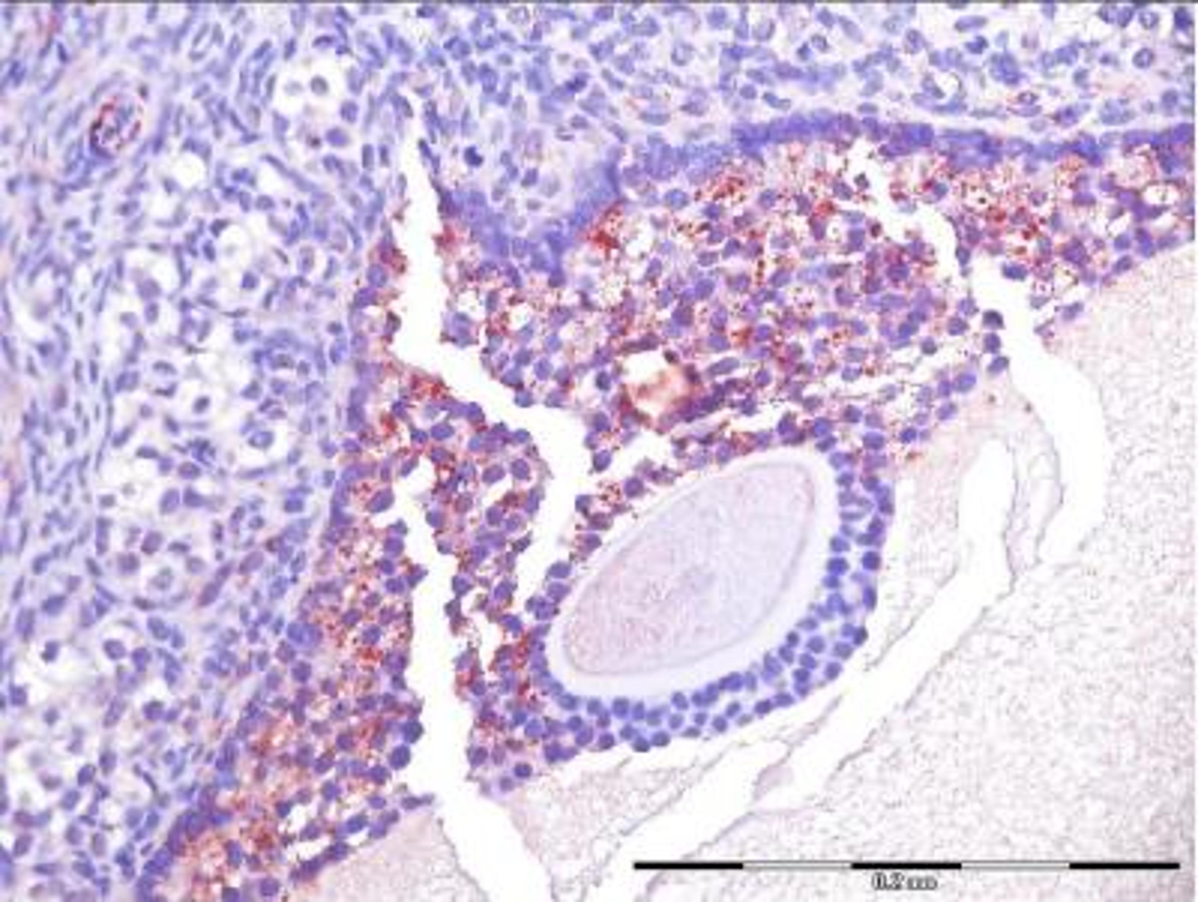 Immunohistochemistry-Paraffin: LHR Antibody [NLS1436] - Analysis of anti-LHR receptor antibody with the middle size antral follicle (1.5 mm) of human ovary. Image from confirmed customer review.