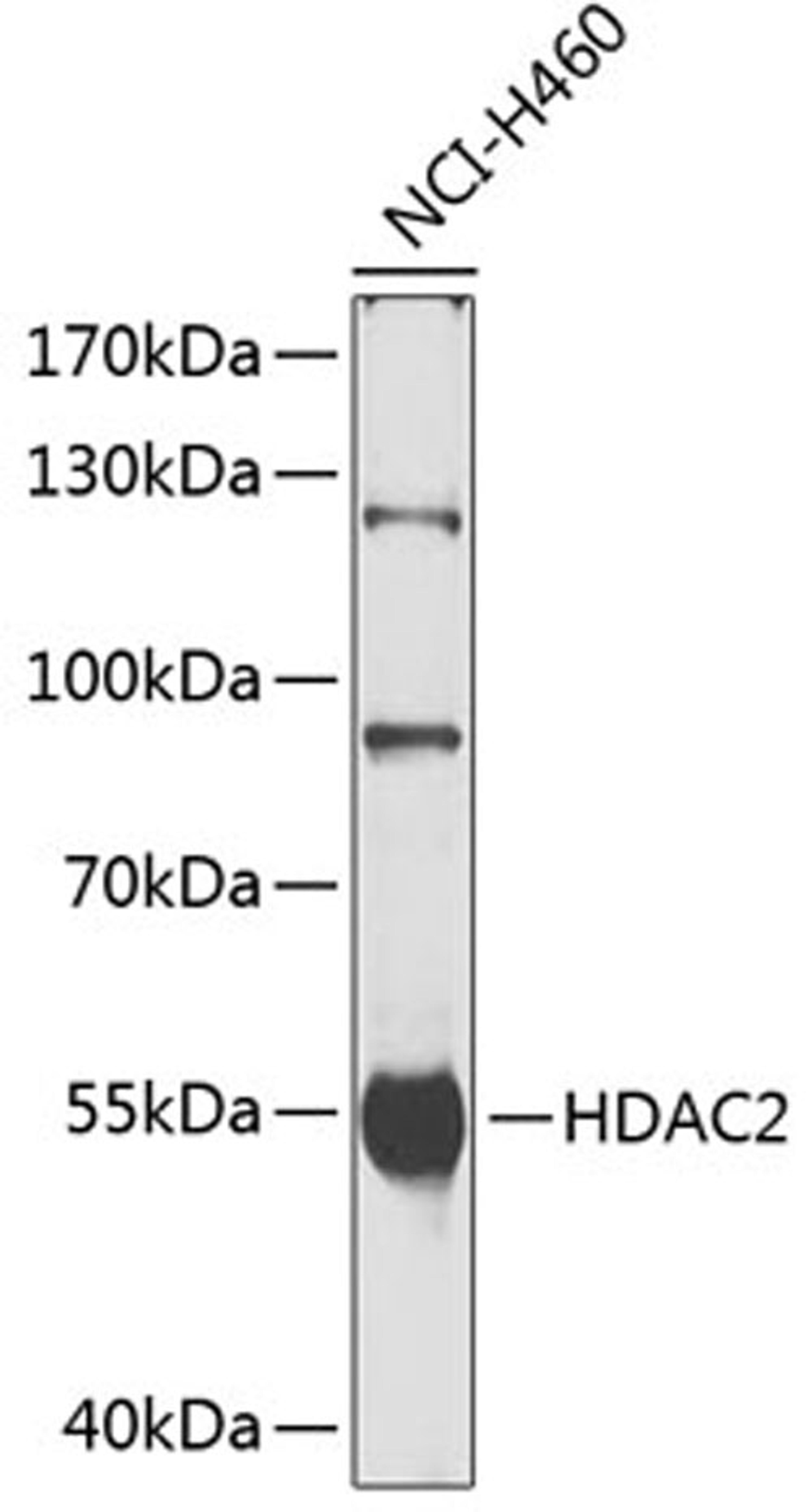 Western blot - HDAC2 antibody (A0867)