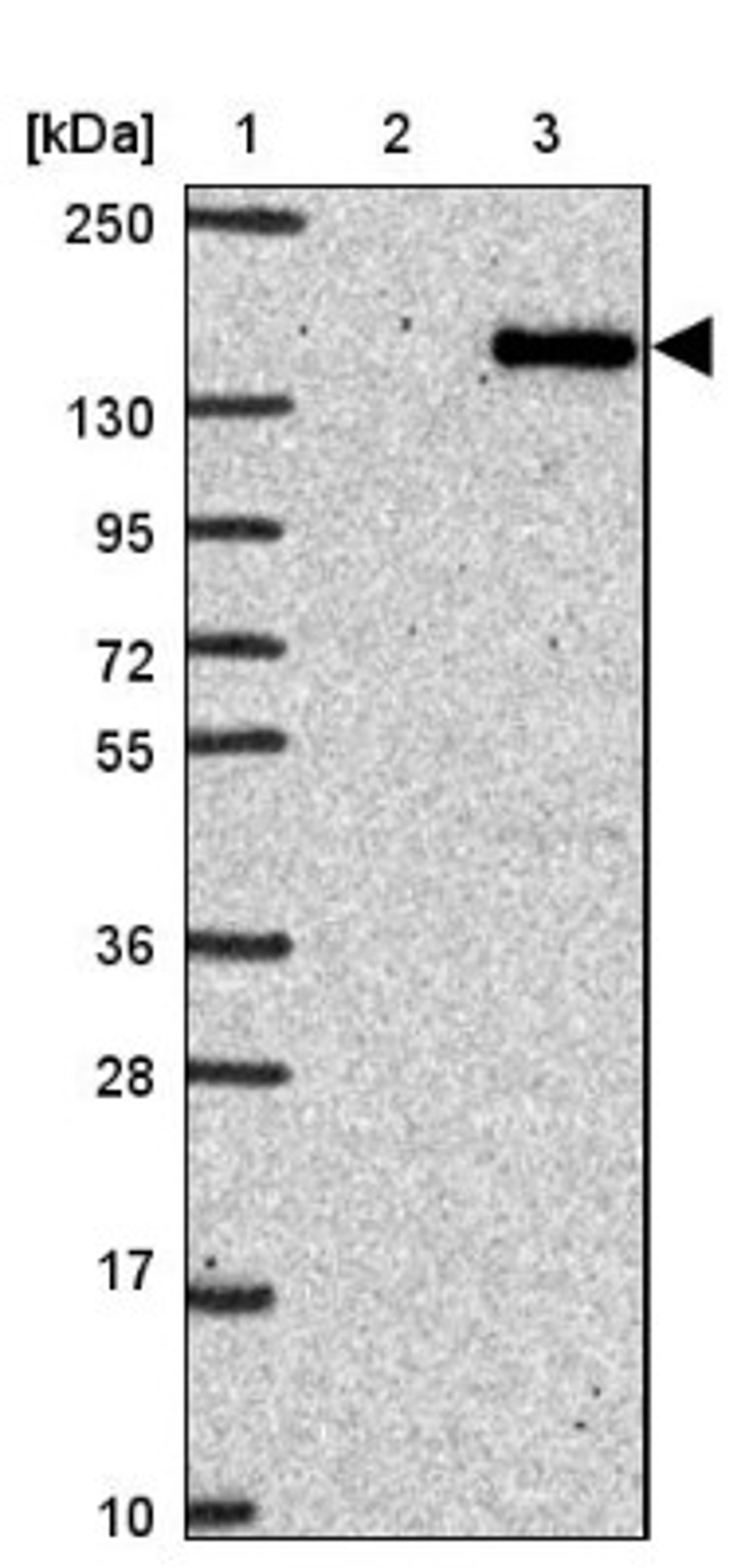 Western Blot: PTPN14/PTPD2 Antibody [NBP2-38712] - Lane 1: Marker [kDa] 250, 130, 95, 72, 55, 36, 28, 17, 10<br/>Lane 2: RT-4<br/>Lane 3: U-251 MG