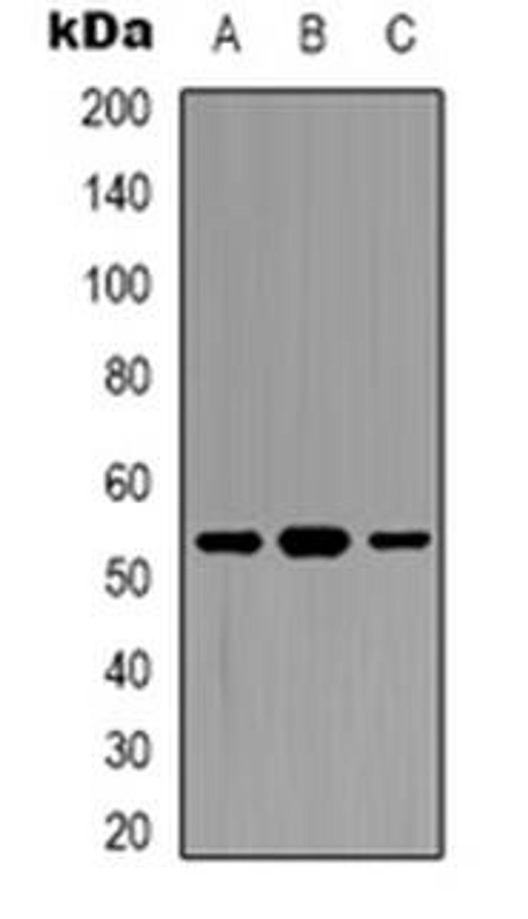 Western blot analysis of DDX19B expression in HepG2 (Lane 1), K562 (Lane 2), A549 (Lane 3) whole cell lysates using DDX19B antibody