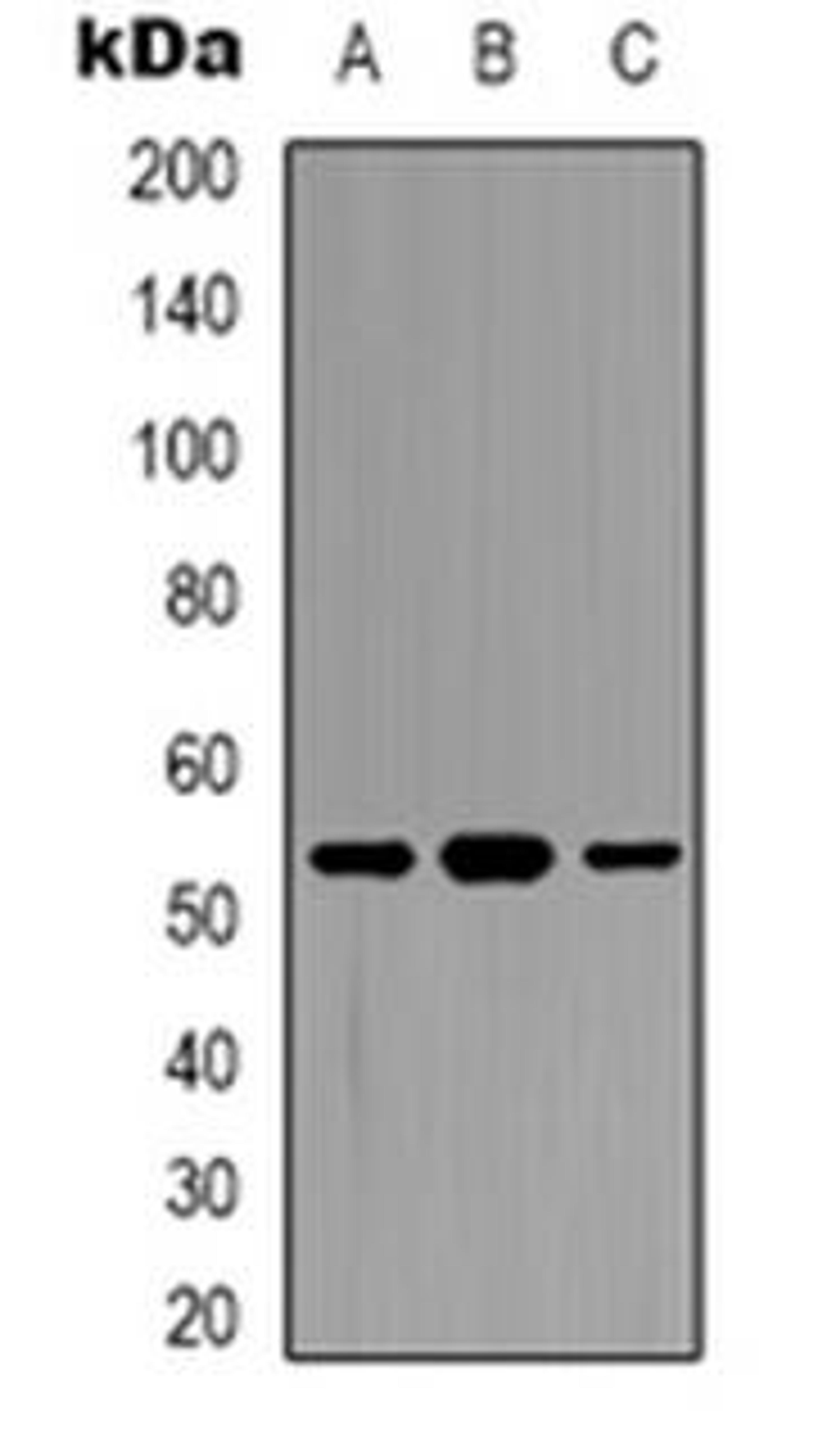 Western blot analysis of DDX19B expression in HepG2 (Lane 1), K562 (Lane 2), A549 (Lane 3) whole cell lysates using DDX19B antibody