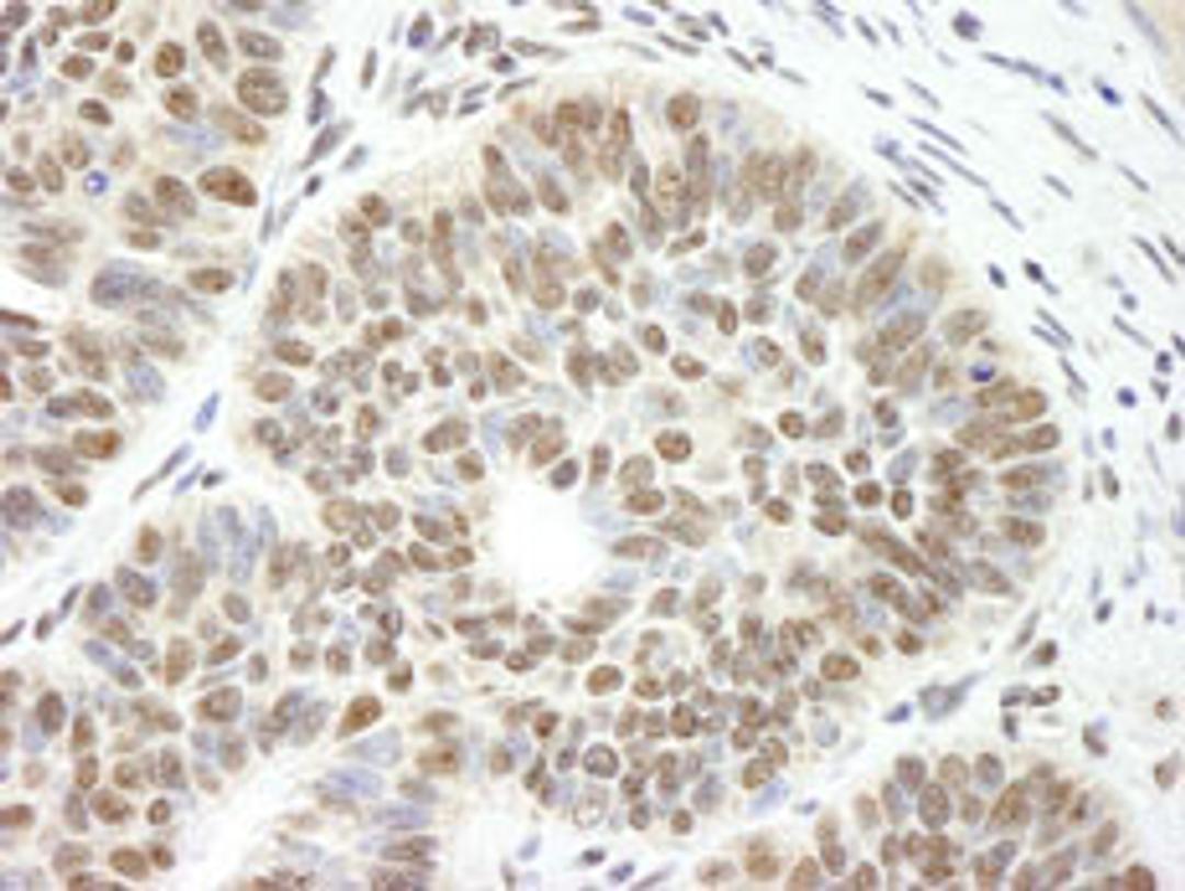 Detection of human CCAR1 by immunohistochemistry.