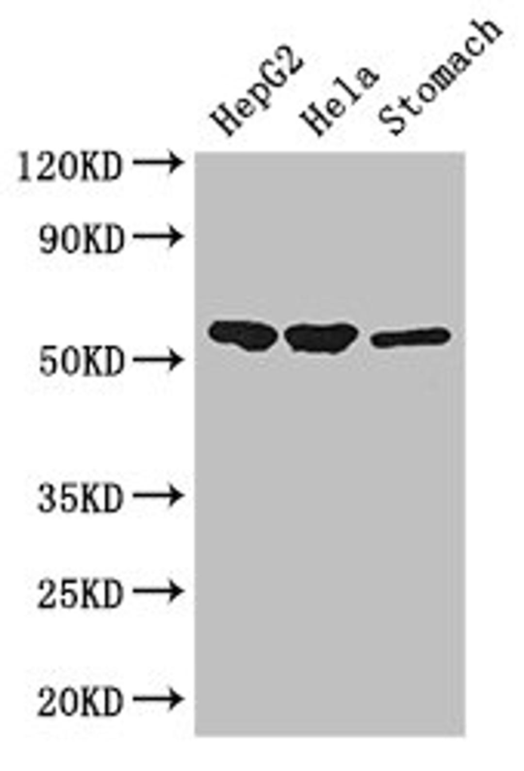 Western Blot. Positive WB detected in: HepG2 whole cell lysate, Hela whole cell lysate, Mouse stomach tissue. All lanes: SLC37A2 antibody at 3ug/ml. Secondary. Goat polyclonal to rabbit IgG at 1/50000 dilution. Predicted band size: 55, 43, 14 kDa. Observed band size: 55 kDa.