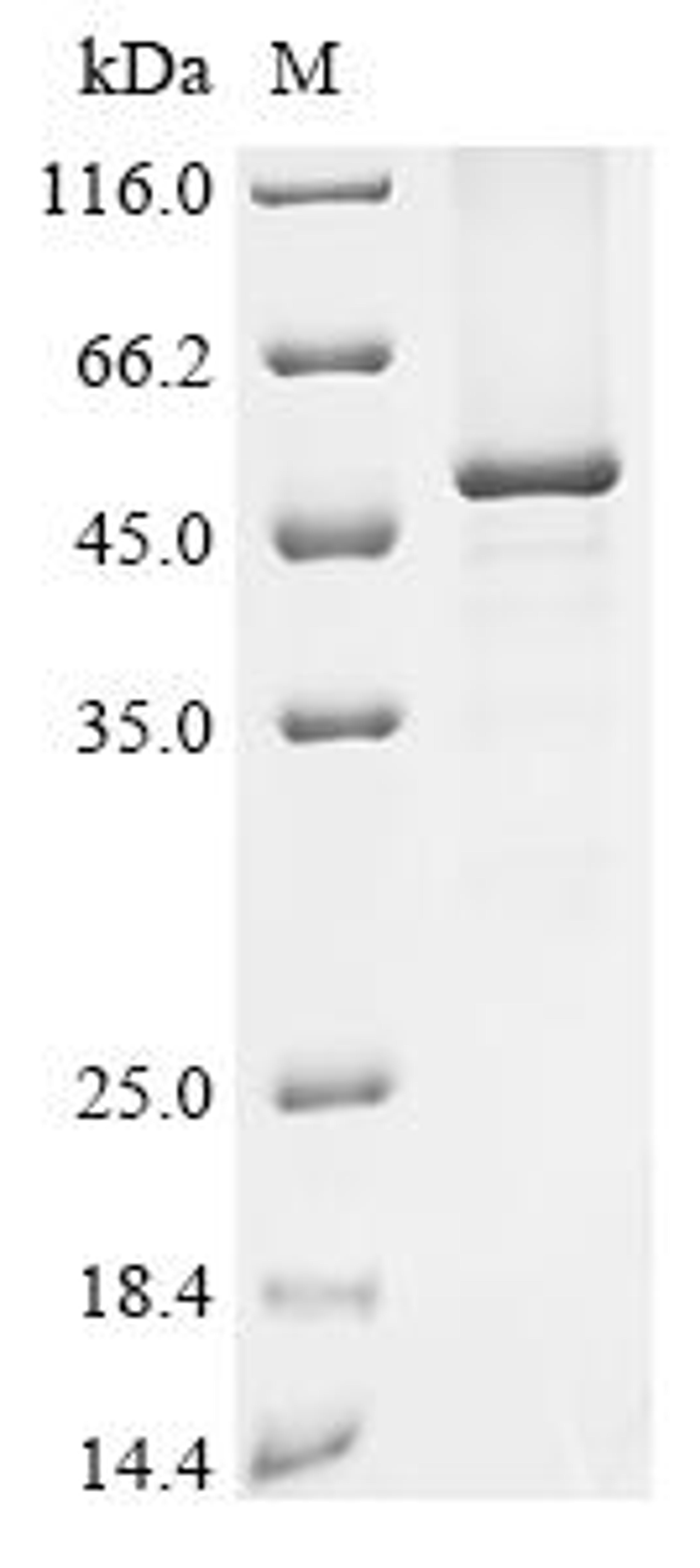 (Tris-Glycine gel) Discontinuous SDS-PAGE (reduced) with 5% enrichment gel and 15% separation gel.