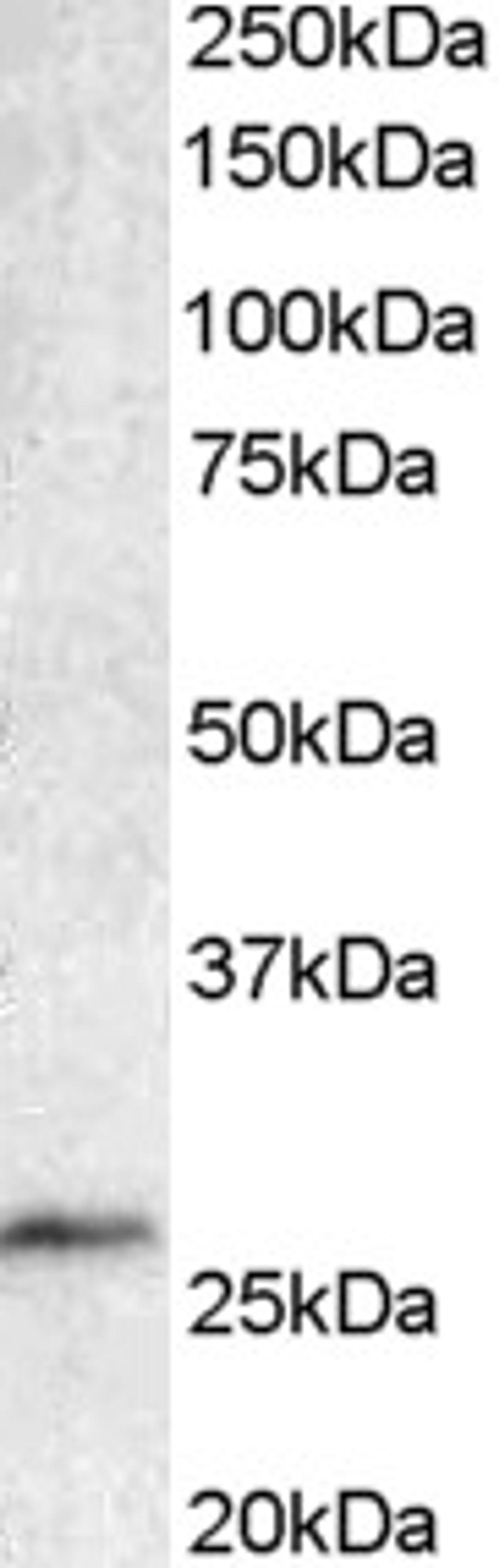 45-325 staining (1ug/ml) of Human Lymphnode lysate (RIPA buffer, 35ug total protein per lane). Primary incubated for 1 hour. Detected by western blot using chemiluminescence.