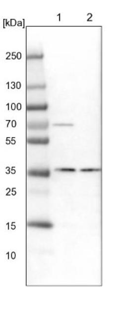 Western Blot: CPT2 Antibody [NBP1-85471] - Lane 1: NIH-3T3 cell lysate (Mouse embryonic fibroblast cells)<br/>Lane 2: NBT-II cell lysate (Rat Wistar bladder tumour cells)