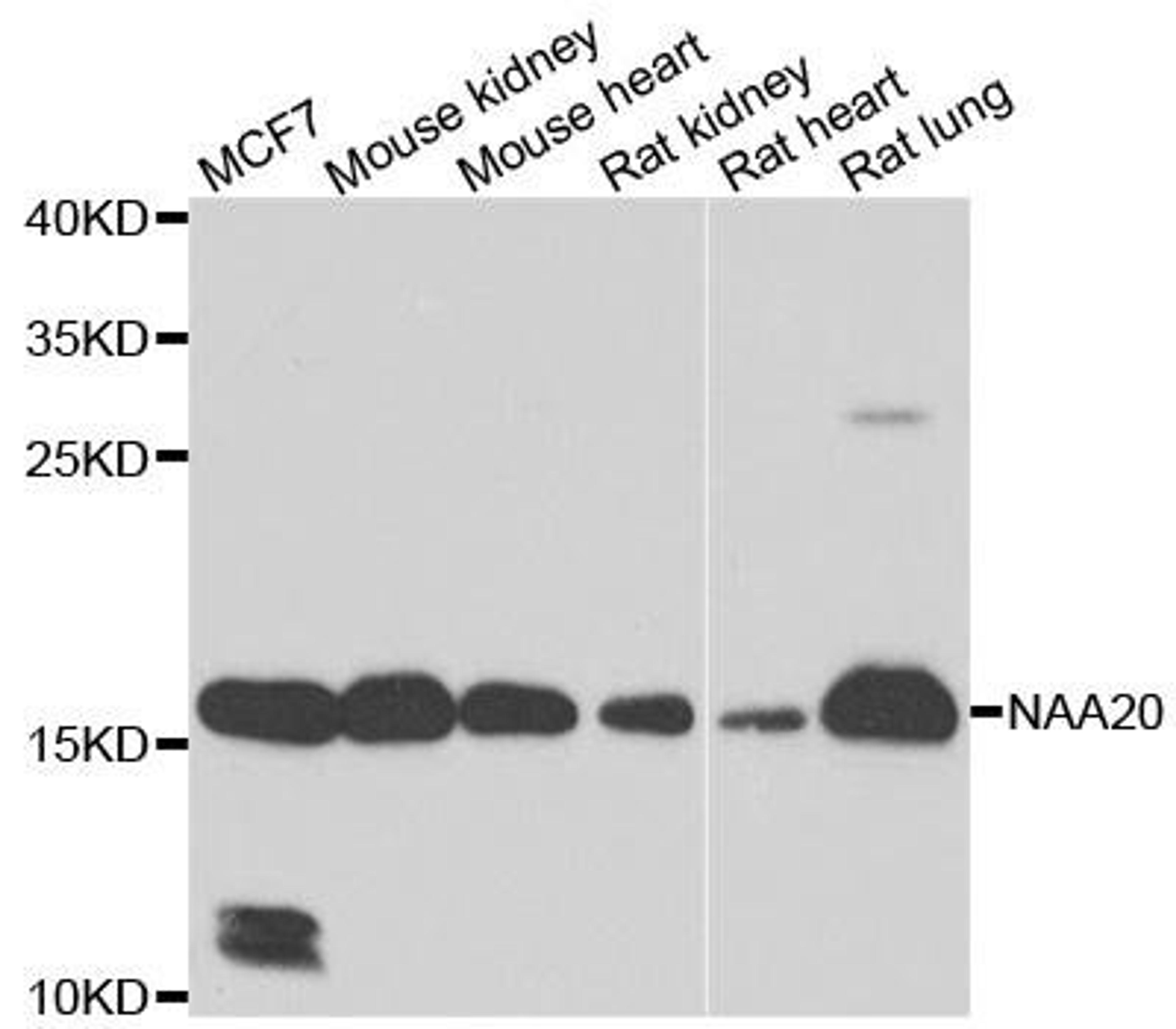 Western blot analysis of extracts of various cell lines using NAA20 antibody