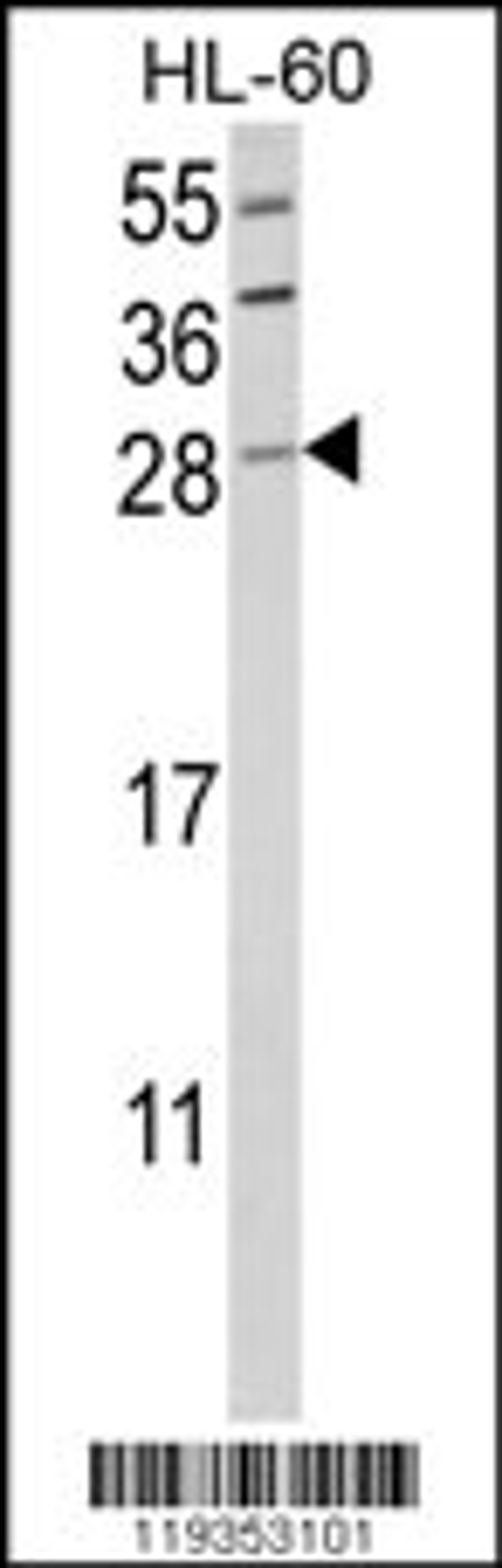 Western blot analysis of GZMB Antibody in HL-60 cell line lysates (35ug/lane)